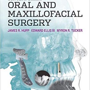 Contemporary Oral and Maxillofacial Surgery (6th Edition) - eBook