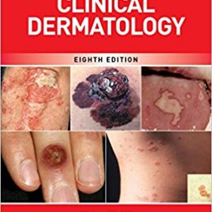 Fitzpatrick's Color Atlas and Synopsis of Clinical Dermatology (8th Edition) - eBook