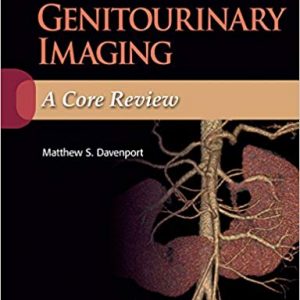 Genitourinary Imaging: A Core Review - eBook