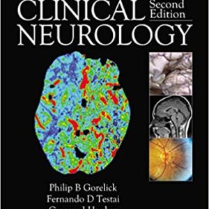 Hankey's Clinical Neurology (2nd Edition) - eBook