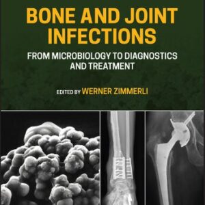 Bone and Joint Infections: From Microbiology to Diagnostics and Treatment (2nd Edition) - eBook