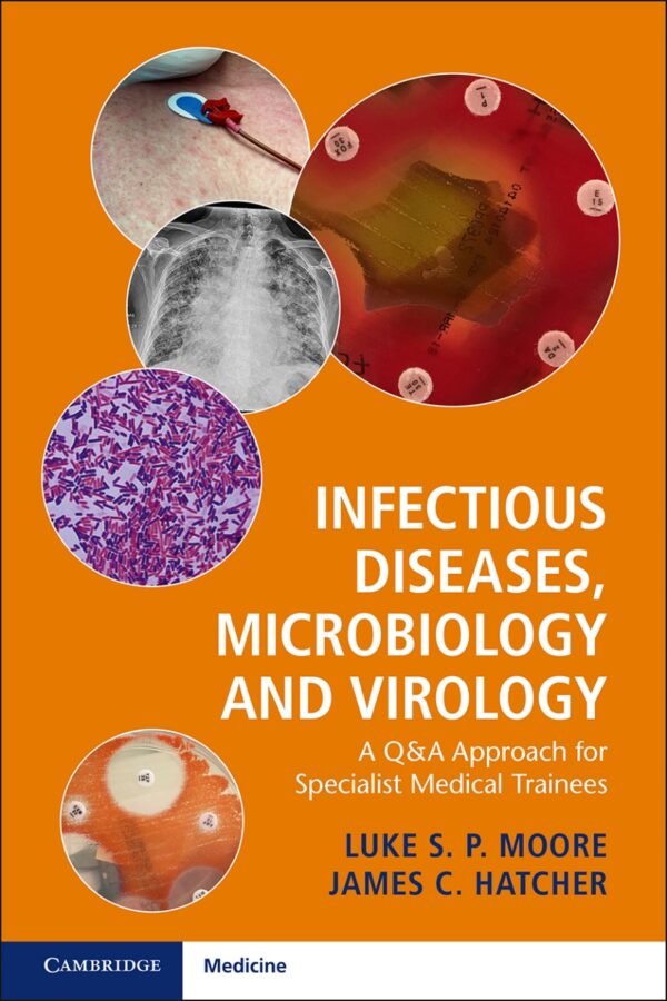 Infectious Diseases, Microbiology and Virology: A Q&A Approach for Specialist Medical Trainees - eBook